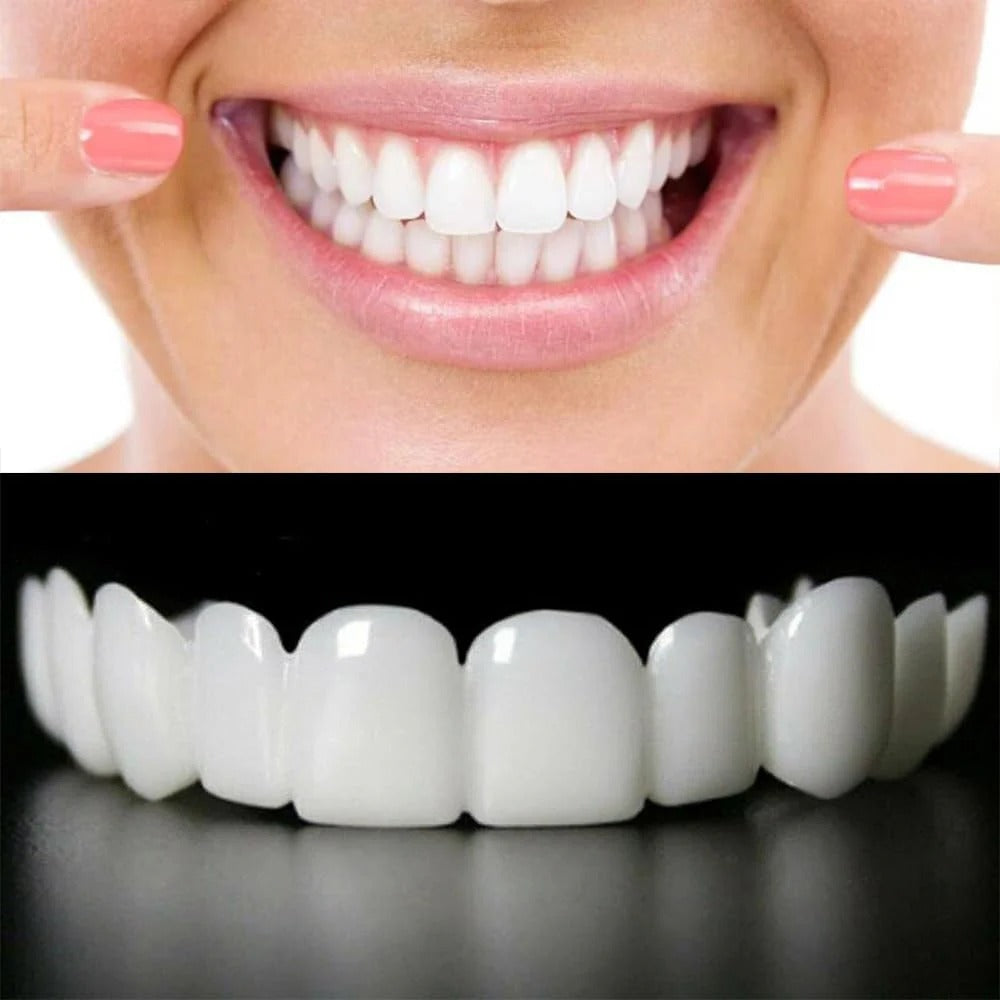 غطاء أسنان تجميلي فوري للحصول على ابتسامة طبيعية وأكثر إشراقًا