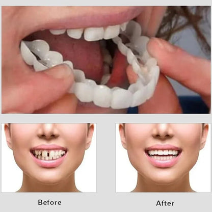 snap-on-smile-cosmetic-teeth-cover_4 - NIMAH