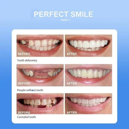 snap-on-smile-cosmetic-teeth-cover_6 - NIMAH